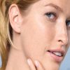 Tìm hiểu về da mặt khô và cách chữa trị da mặt bị khô